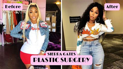 surgery sierra from love and hip hop|LAHHs Sierra Gates Plastic Surgeries and Tattoos